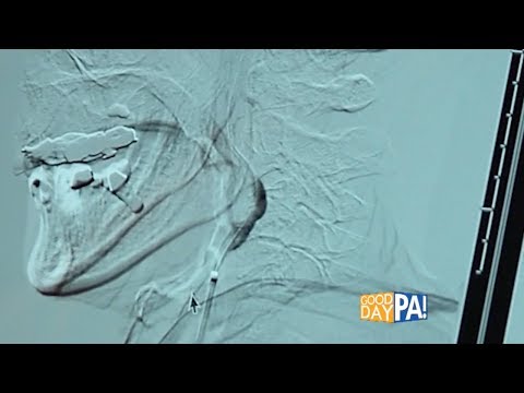 Penn State Rehabilitation Hospital: Comprehensive Services and Care