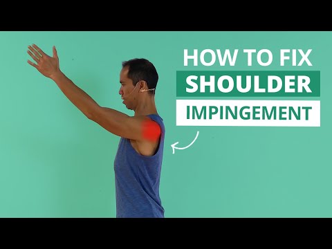 Effective Shoulder Impingement Rehab Strategies to Speed Up Recovery