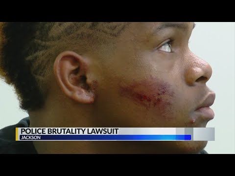 Understanding the Statute of Limitations on Police Misconduct