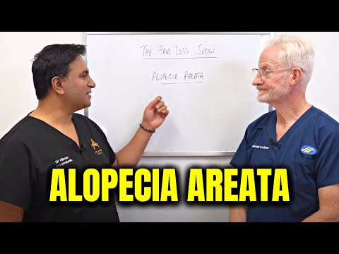 Understanding CTP 543 for Alopecia Areata: Everything You Need to Know