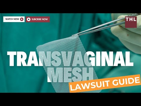 American Medical Systems Mesh Class Action Lawsuit Information and Updates