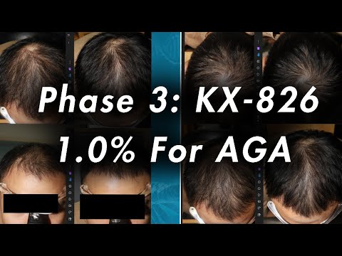 Kintor Phase 3 Clinical Trial Updates and Implications for Treatment